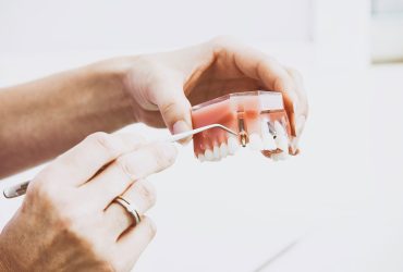 Periodontal Therapy