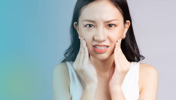 FAQ – Wisdom Teeth