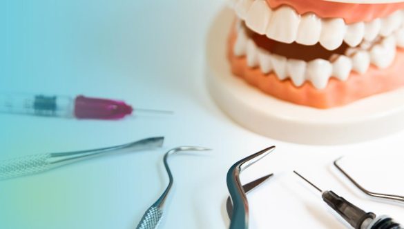 Periodontal Treatments and Cases