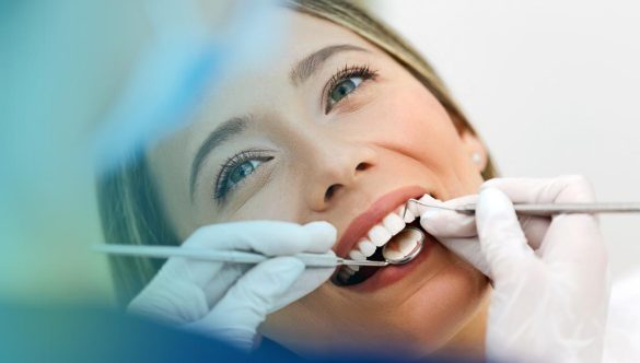 Gingivectomía y Gingivoplastia